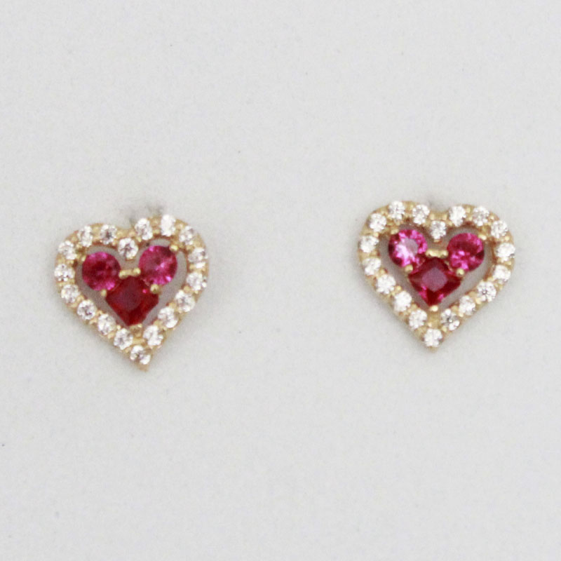 ARETES ORTOPÉDICOS DIONE